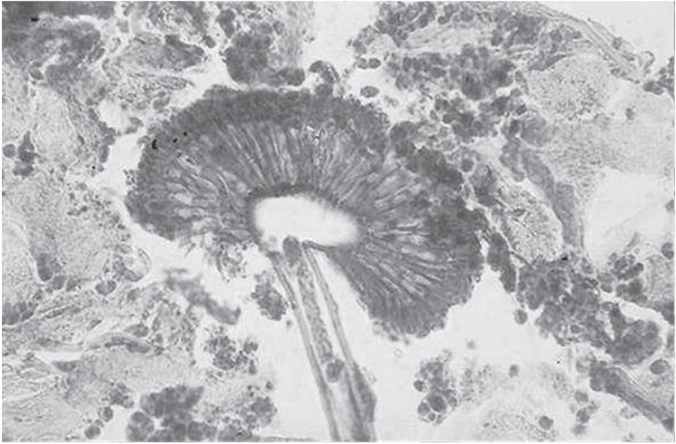 ������� ����� Aspergillus � ����� ������� ��� ���������� ������������ (�� ���������� ����������� Kaminski)